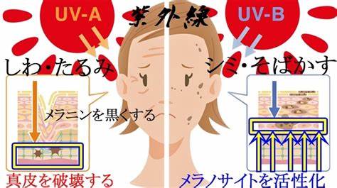 紫外線ダメージ